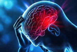Waspadai Stroke di Usia Muda, Kenali Faktor Risiko dan Gejalanya